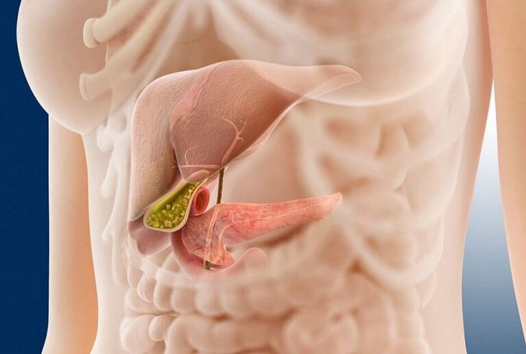 ¿Qué es la pancreatitis